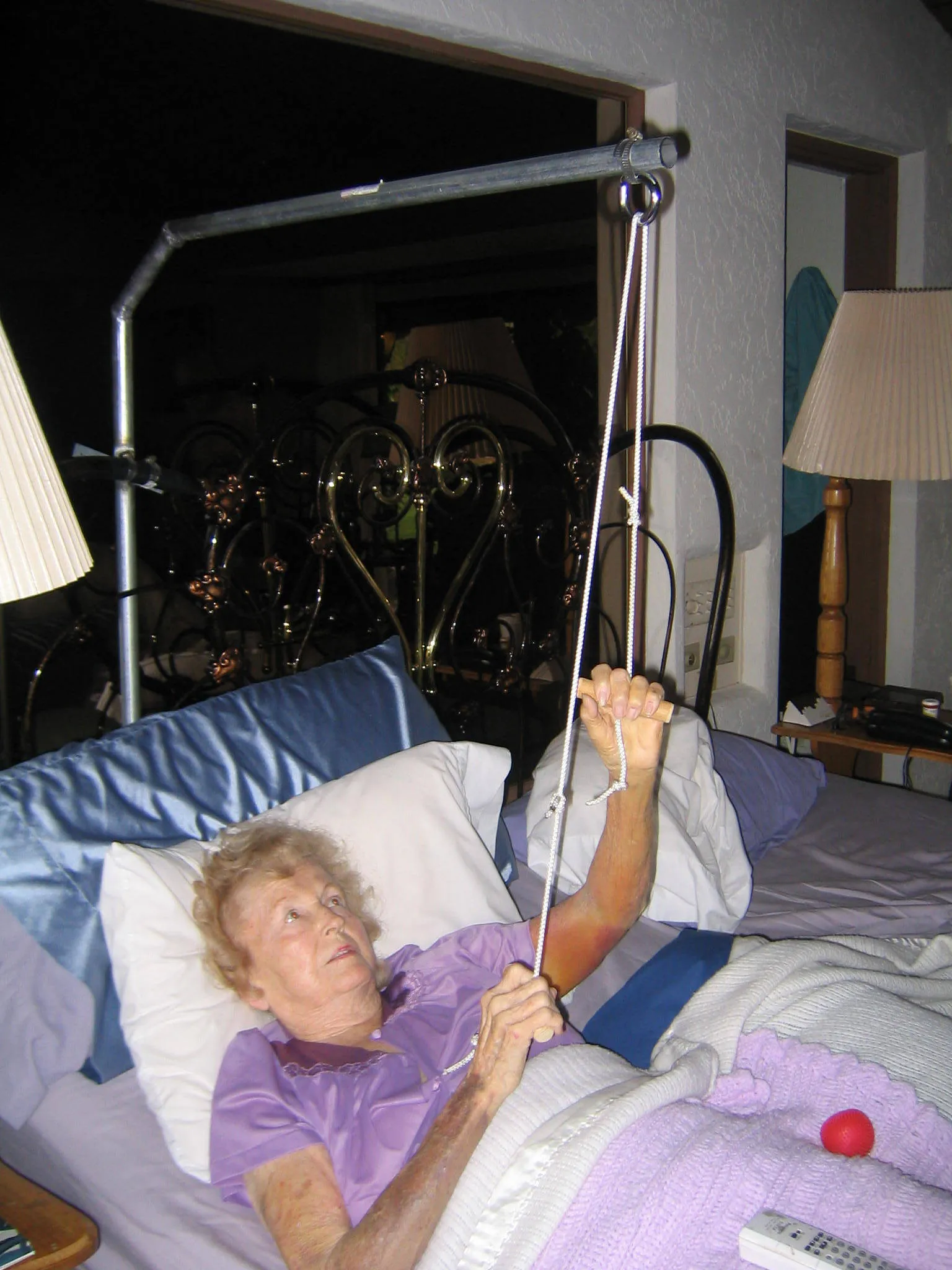 Phyllis Gets A New Shoulder